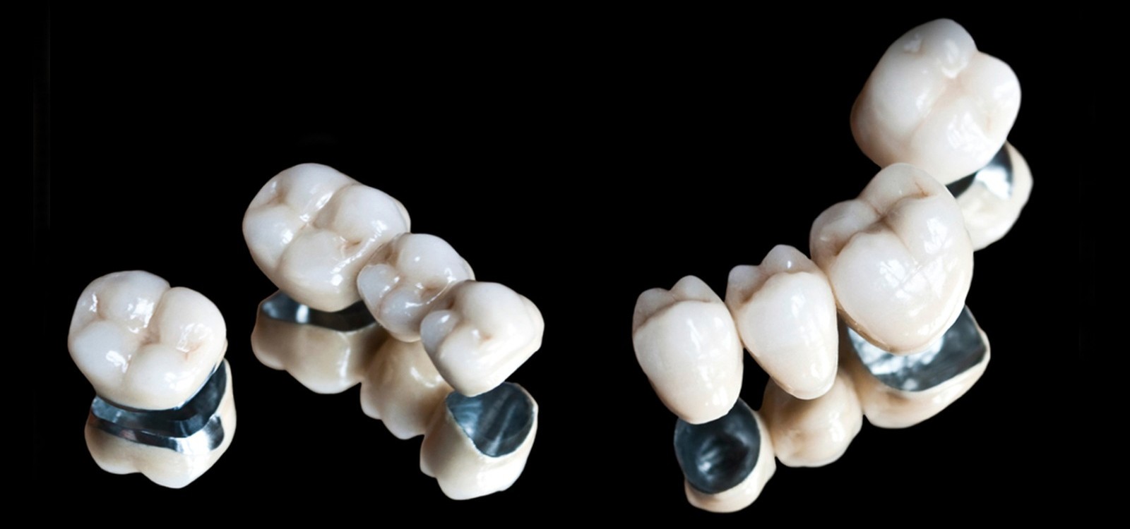 Porselen Diş - Diş Hekimi Muhammet Aktürk - Trabzon - Türkiye Porselen Diş - Diş Hekimi Muhammet Aktürk - Trabzon - Türkiye