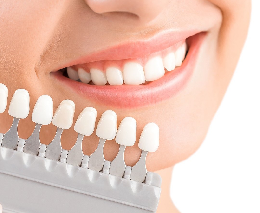 Porselen Diş - Diş Hekimi Muhammet Aktürk - Trabzon - Türkiye Porselen Diş - Diş Hekimi Muhammet Aktürk - Trabzon - Türkiye