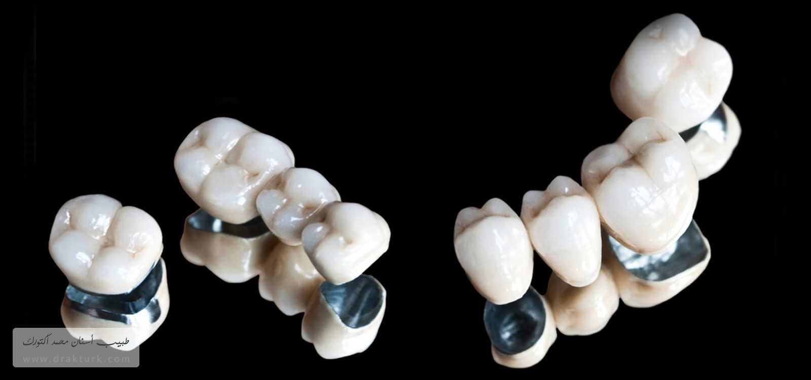 تيجان وجسور الأسنان - طبيب أسنان محمد أكتورك - طرابزون - تركيا