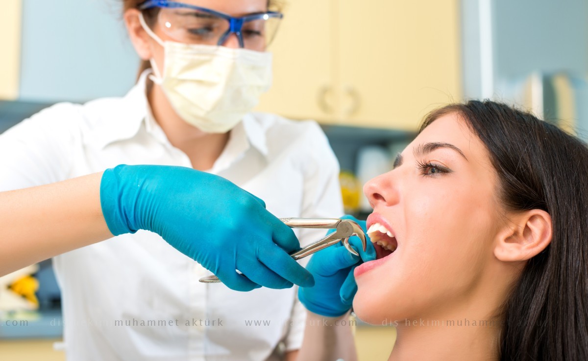 Tooth Extraction - Muhammet Akturk - Dentist - Trabzon - Turkey Tooth Extraction - Muhammet Akturk - Dentist - Trabzon - Turkey