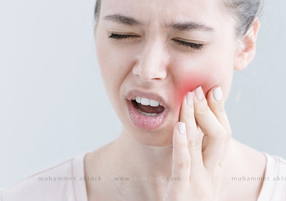 إزالة ضرس العقل - محمد أكتورك - طبيب أسنان - طرابزون - تركيا