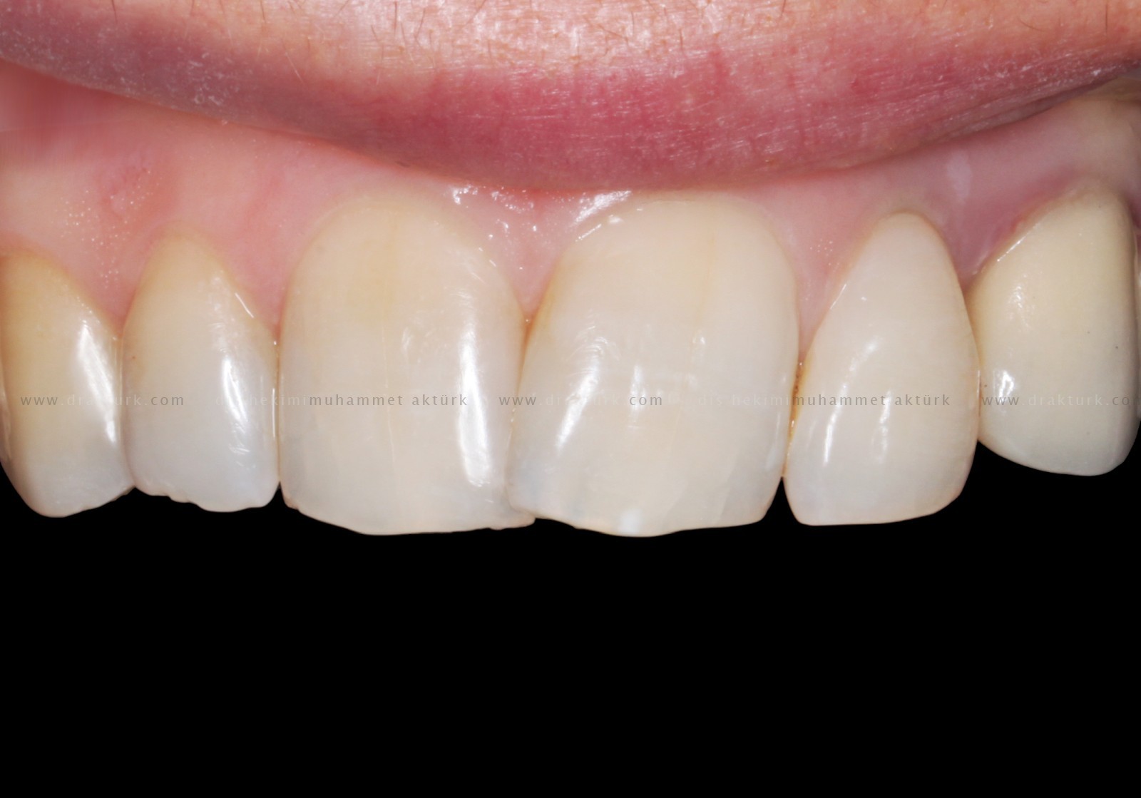 Muhammet Akturk - Dentist - Trabzon - Turkey