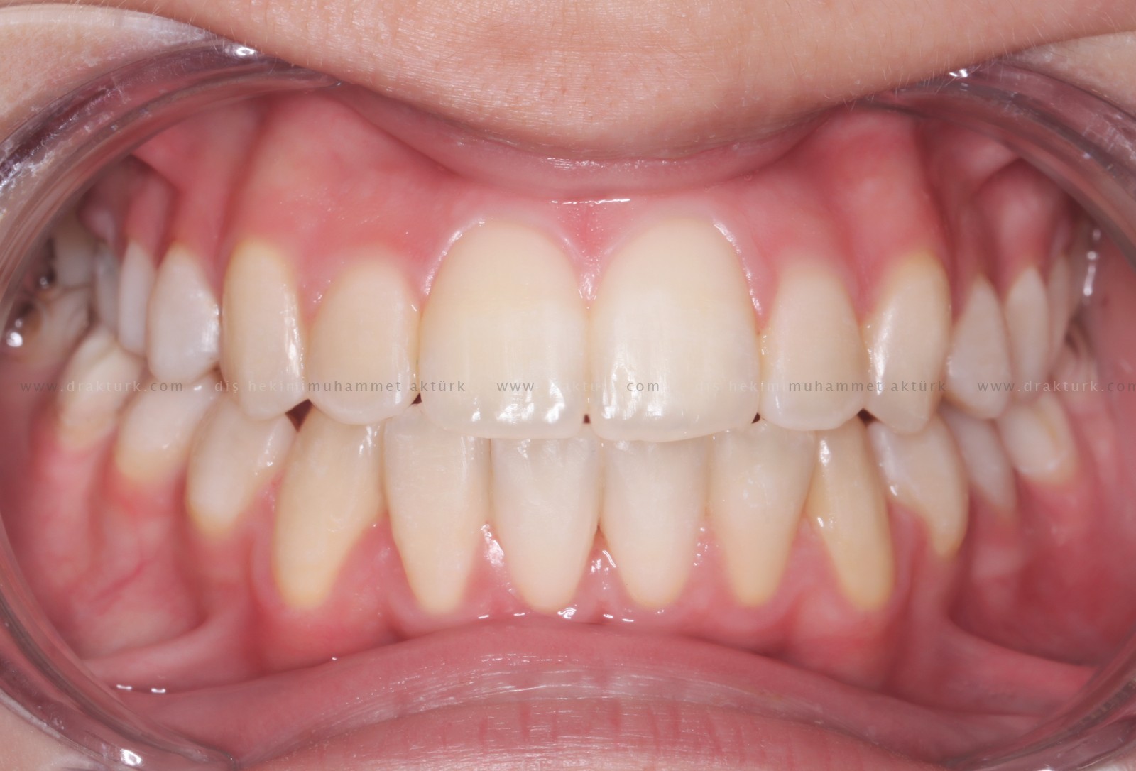 Muhammet Akturk - Dentist - Trabzon - Turkey