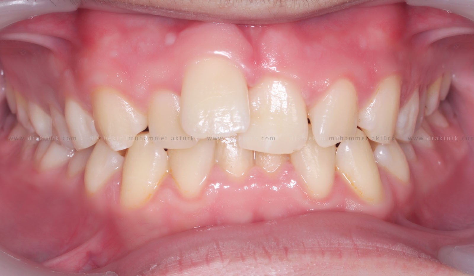 Muhammet Akturk - Dentist - Trabzon - Turkey Muhammet Akturk - Dentist - Trabzon - Turkey