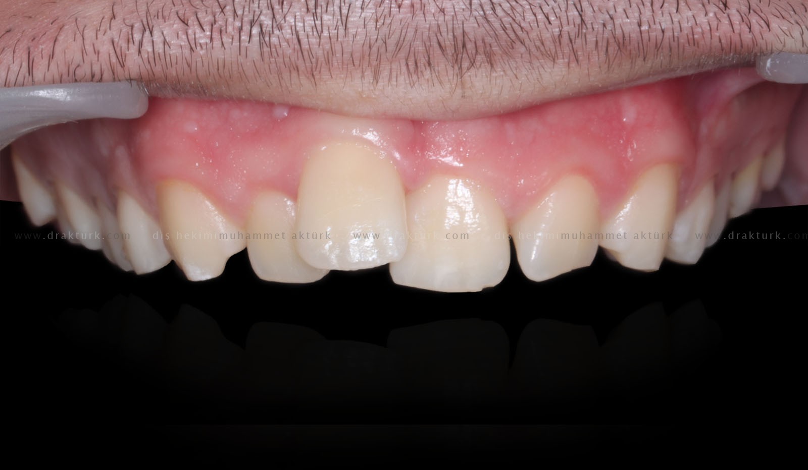 Muhammet Akturk - Dentist - Trabzon - Turkey Muhammet Akturk - Dentist - Trabzon - Turkey