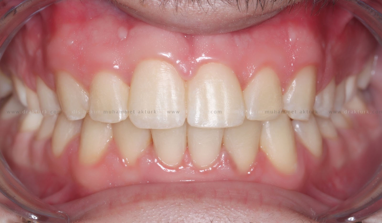 Muhammet Akturk - Dentist - Trabzon - Turkey Muhammet Akturk - Dentist - Trabzon - Turkey