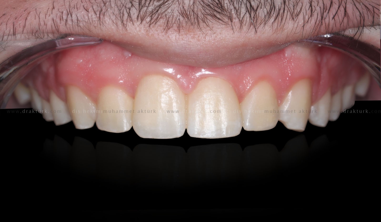 Muhammet Akturk - Dentist - Trabzon - Turkey Muhammet Akturk - Dentist - Trabzon - Turkey