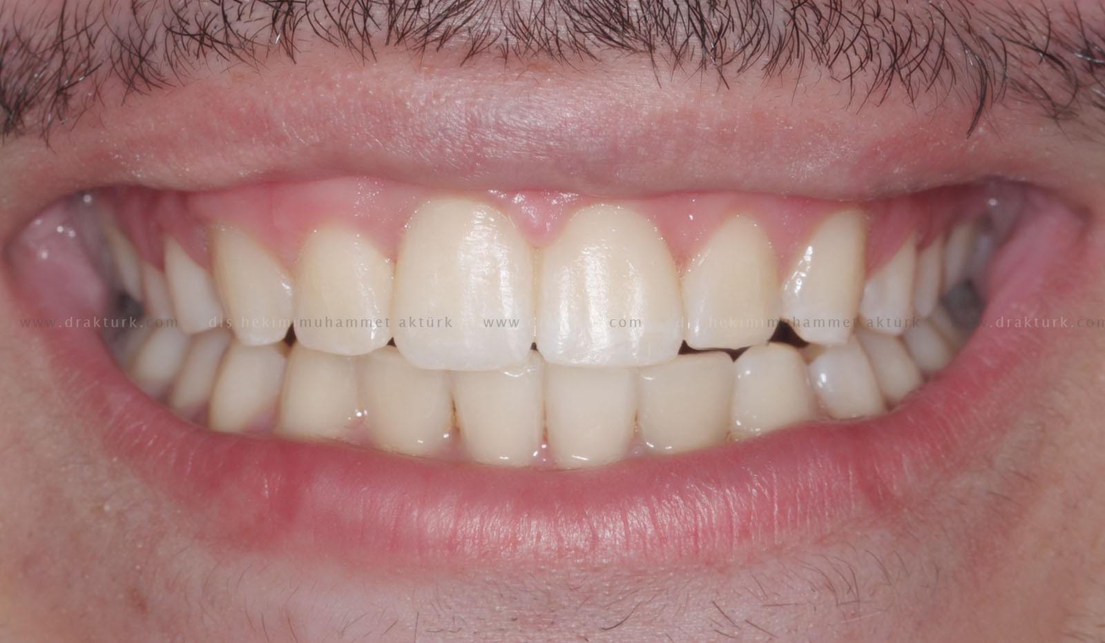 Muhammet Akturk - Dentist - Trabzon - Turkey Muhammet Akturk - Dentist - Trabzon - Turkey