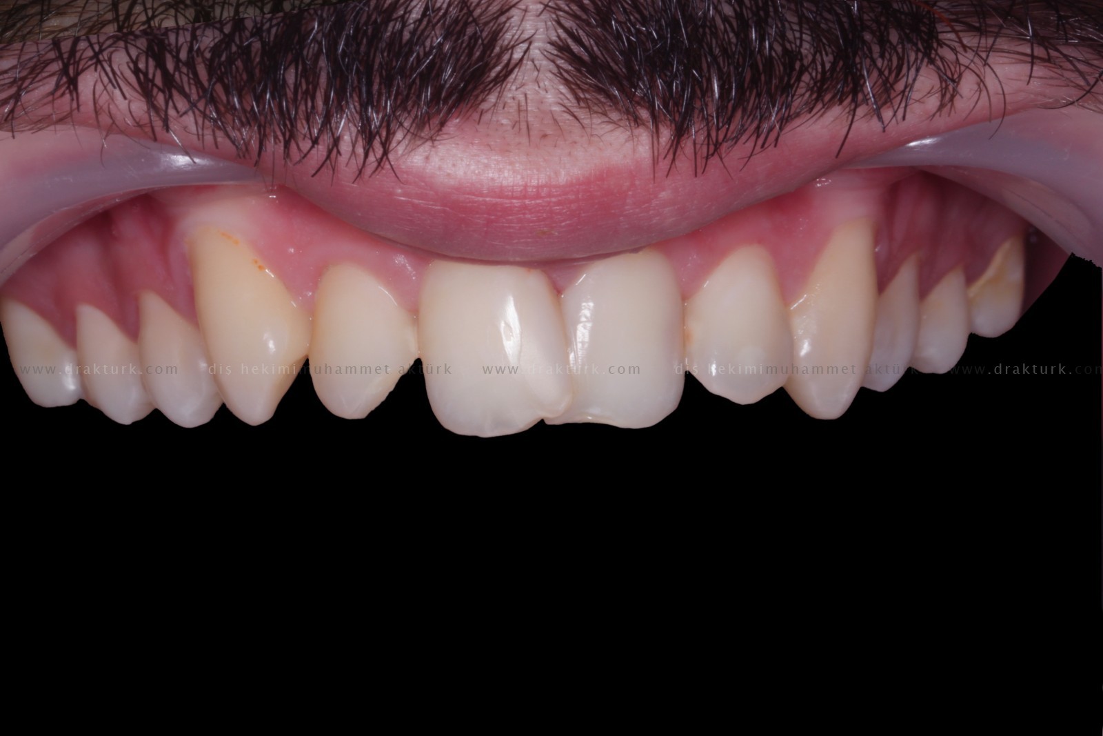 Muhammet Akturk - Dentist - Trabzon - Turkey Muhammet Akturk - Dentist - Trabzon - Turkey