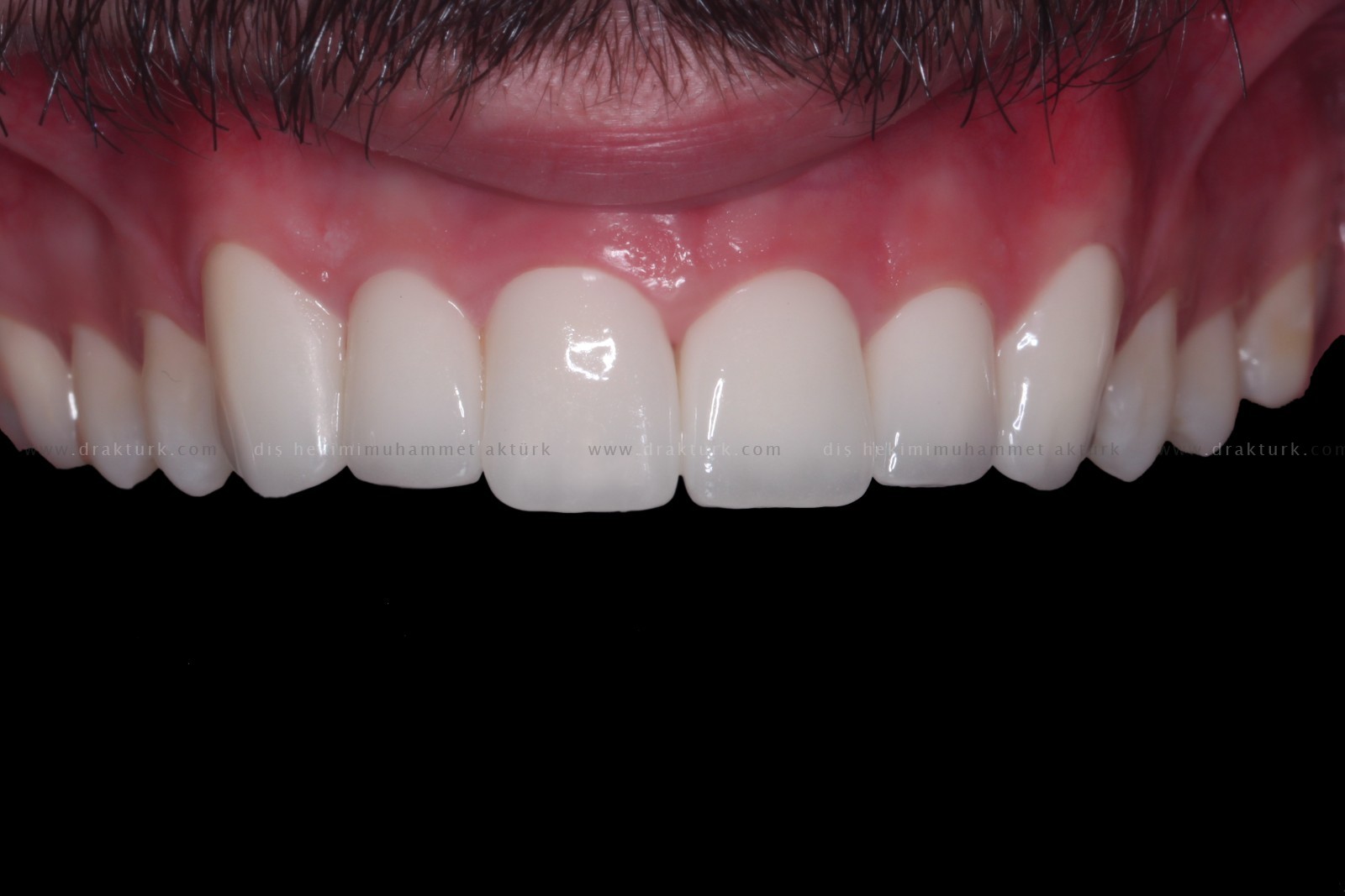 Muhammet Akturk - Dentist - Trabzon - Turkey Muhammet Akturk - Dentist - Trabzon - Turkey