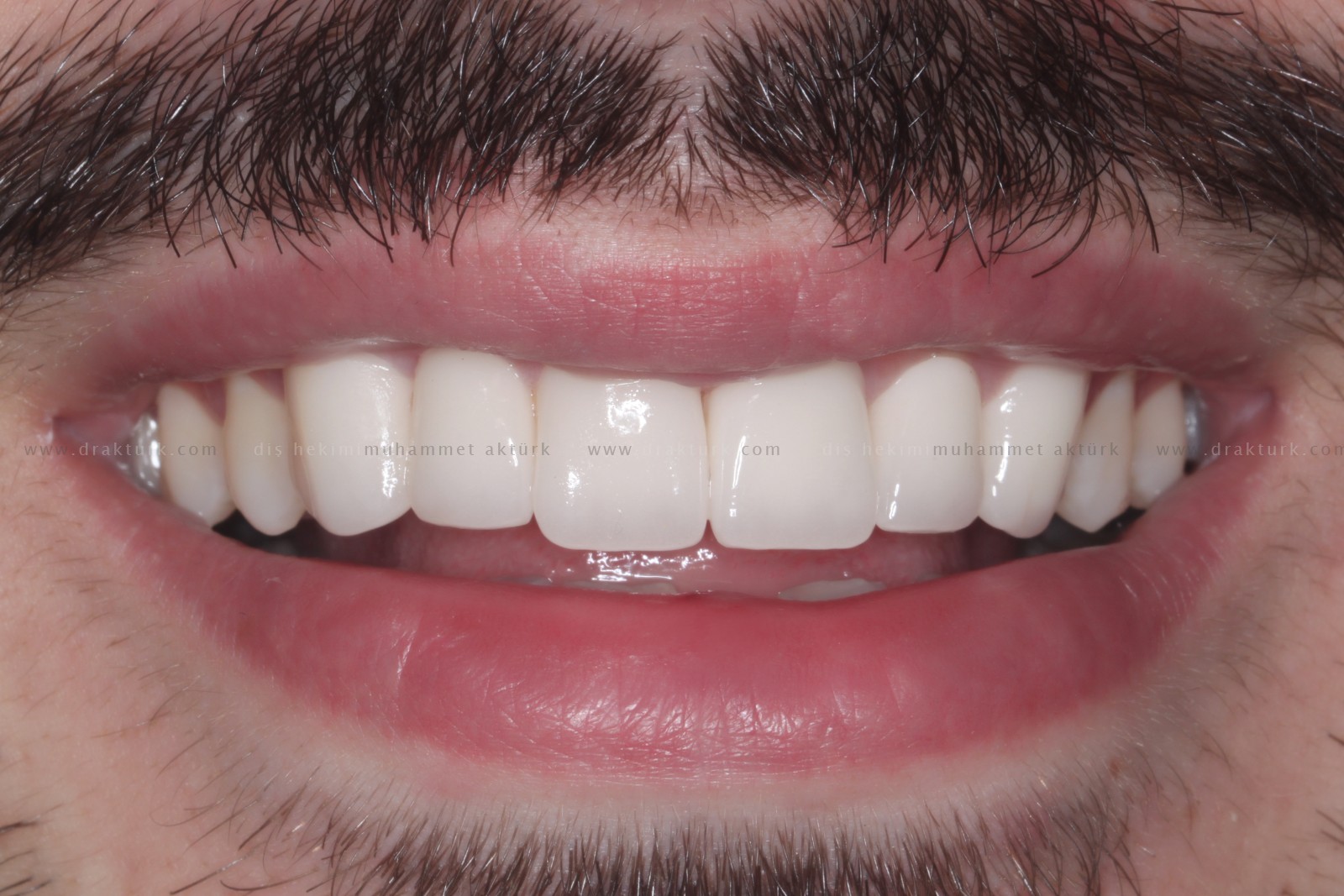 Muhammet Akturk - Dentist - Trabzon - Turkey Muhammet Akturk - Dentist - Trabzon - Turkey