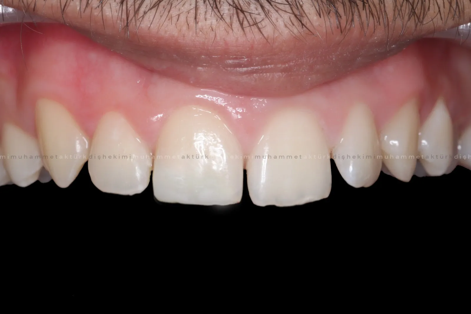 Muhammet Akturk - Dentist - Trabzon - Turkey Muhammet Akturk - Dentist - Trabzon - Turkey