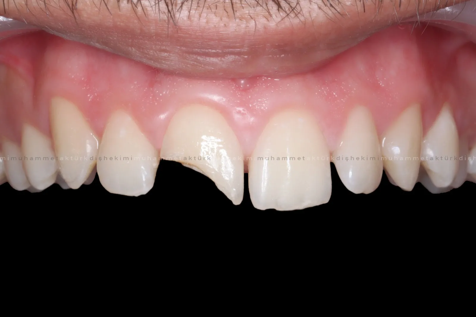 Muhammet Akturk - Dentist - Trabzon - Turkey Muhammet Akturk - Dentist - Trabzon - Turkey