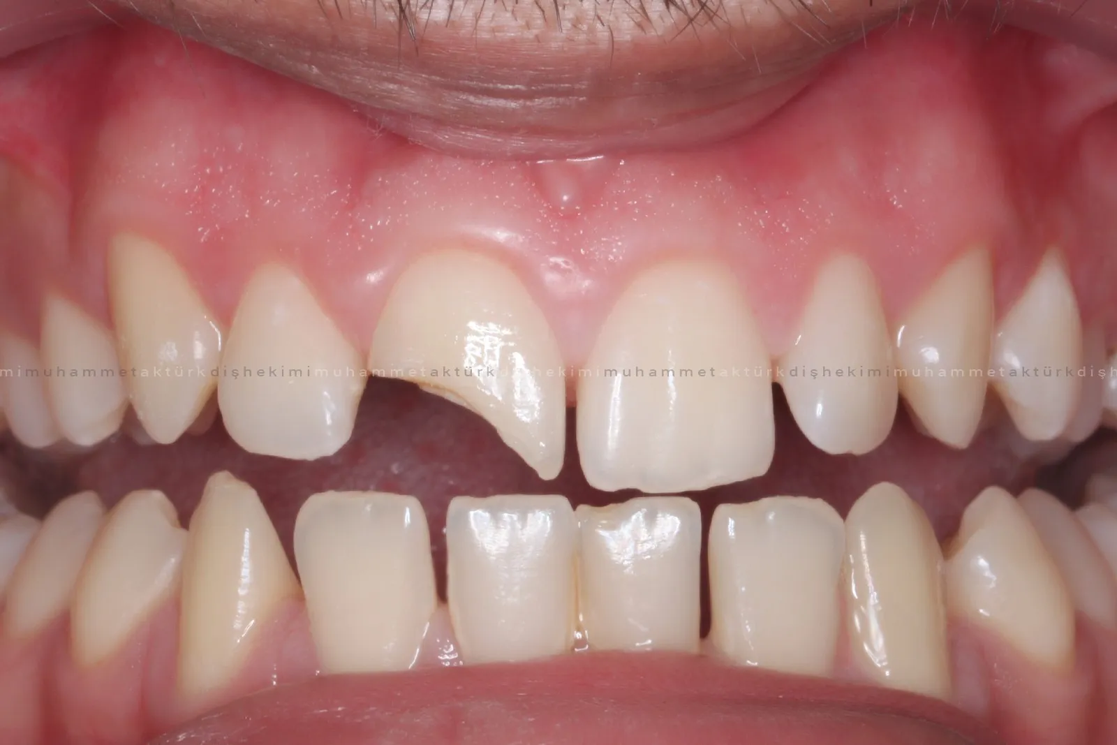 Muhammet Akturk - Dentist - Trabzon - Turkey Muhammet Akturk - Dentist - Trabzon - Turkey