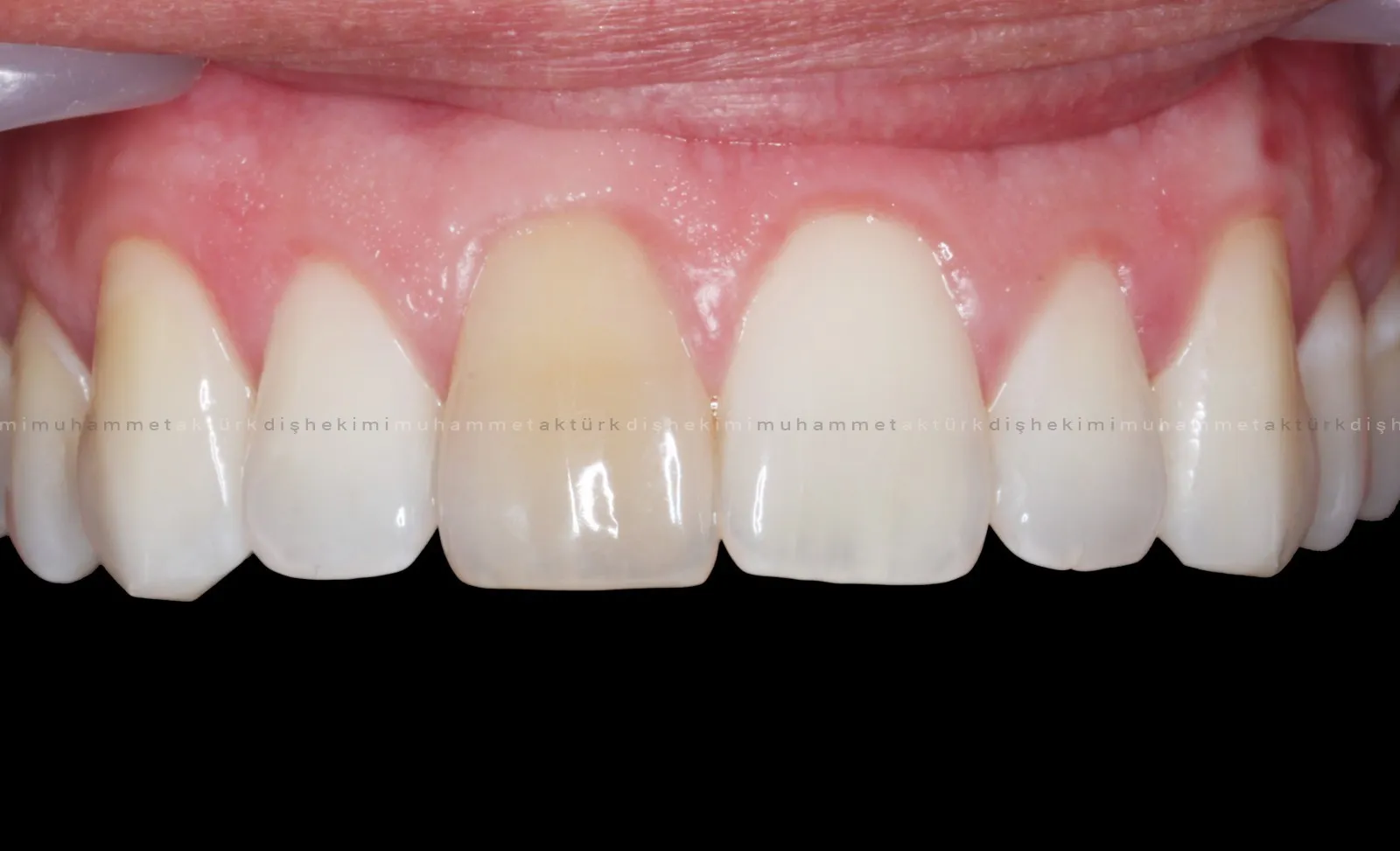 Muhammet Akturk - Dentist - Trabzon - Turkey Muhammet Akturk - Dentist - Trabzon - Turkey