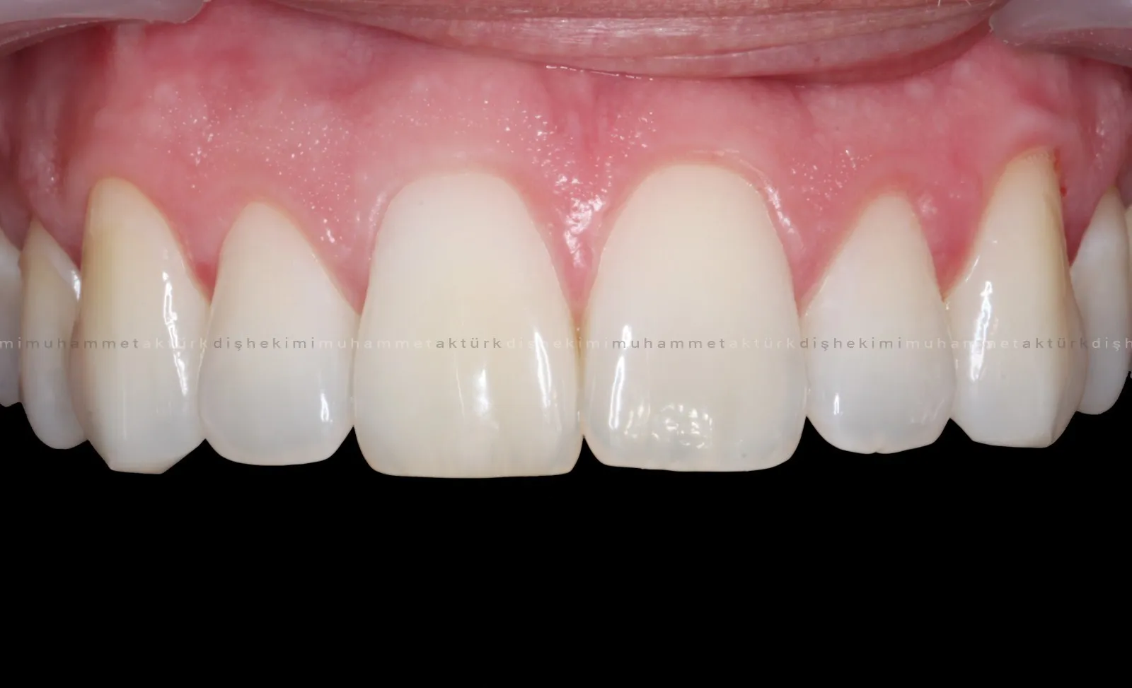 Muhammet Akturk - Dentist - Trabzon - Turkey Muhammet Akturk - Dentist - Trabzon - Turkey