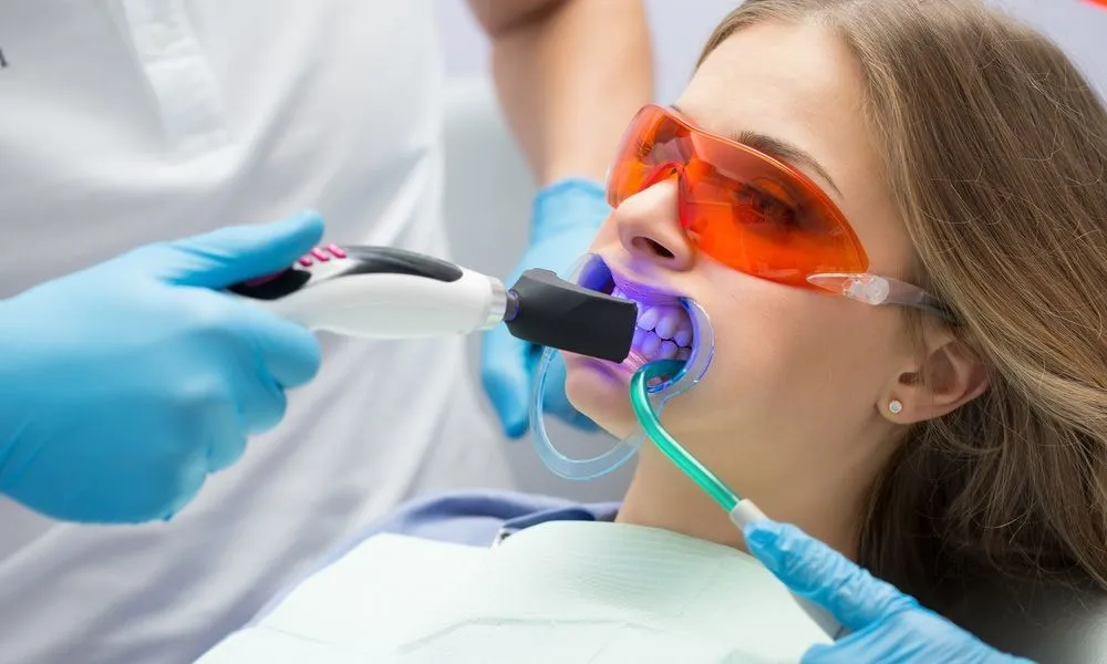 Teeth Whitening - Dentist Muhammet Akturk - Trabzon - Turkey Teeth Whitening - Dentist Muhammet Akturk - Trabzon - Turkey