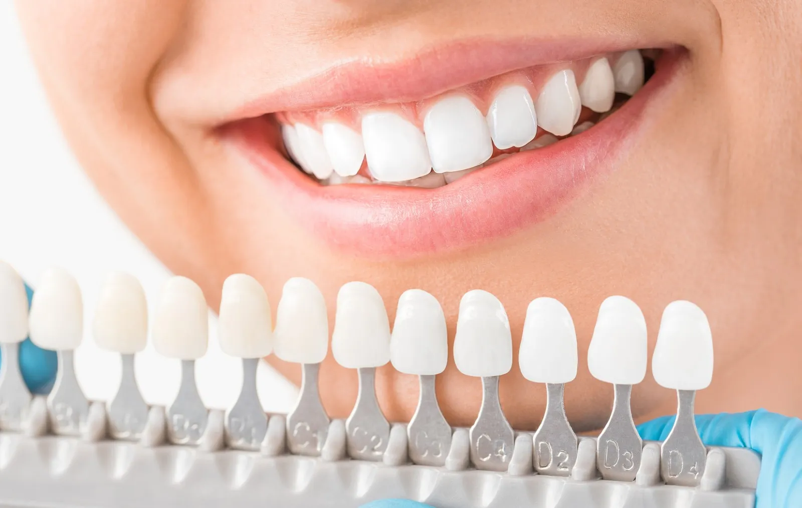 Teeth Whitening - Dentist Muhammet Aktürk - Trabzon - Turkey Teeth Whitening - Dentist Muhammet Aktürk - Trabzon - Turkey