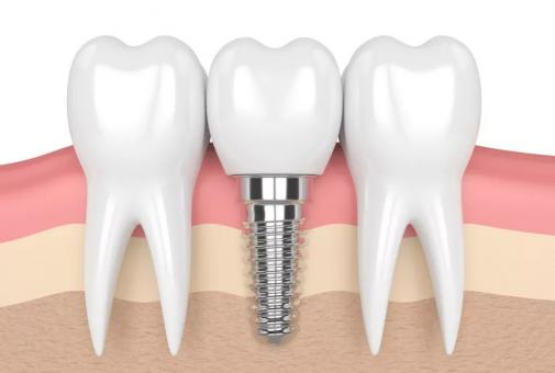  | Dentist Muhammet Akturk | +90 462 277 7777